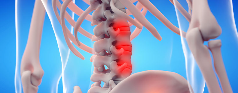 patient needing Ankylosing Spondylitis chiropractor in Richardson TX