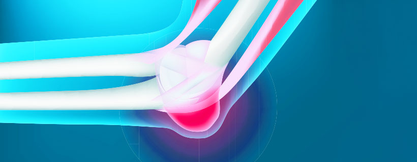 patient needing Bursitis chiropractor in Richardson TX