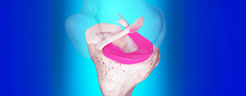 patient needing Ligamentitis chiropractor in Richardson TX